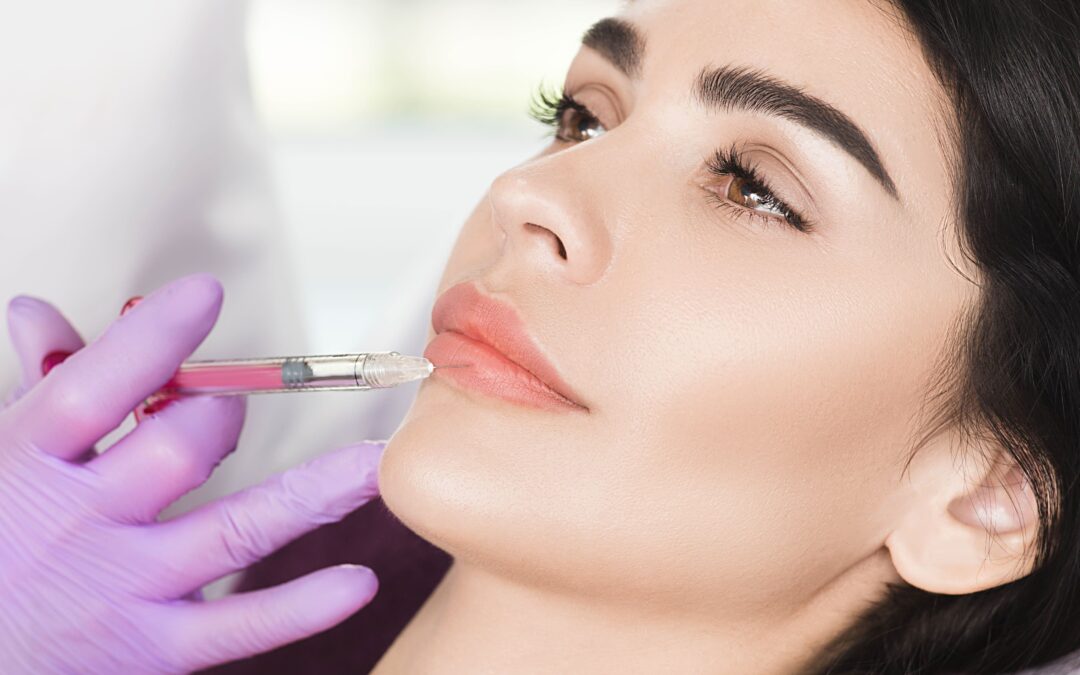 Lippenfüller mit Gefühl – für natürliche Fülle und harmonische Konturen